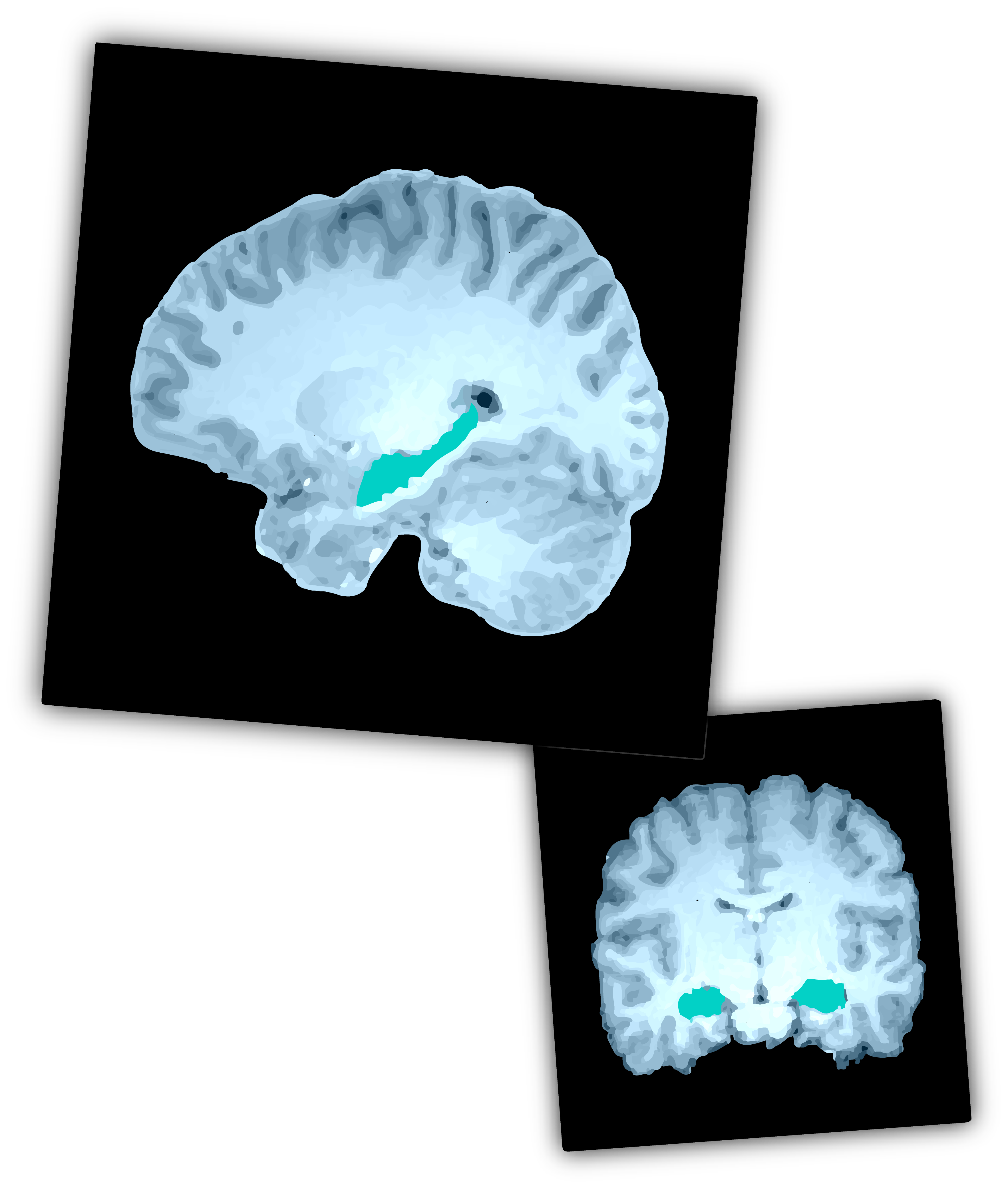 The Science behind HippoCamera